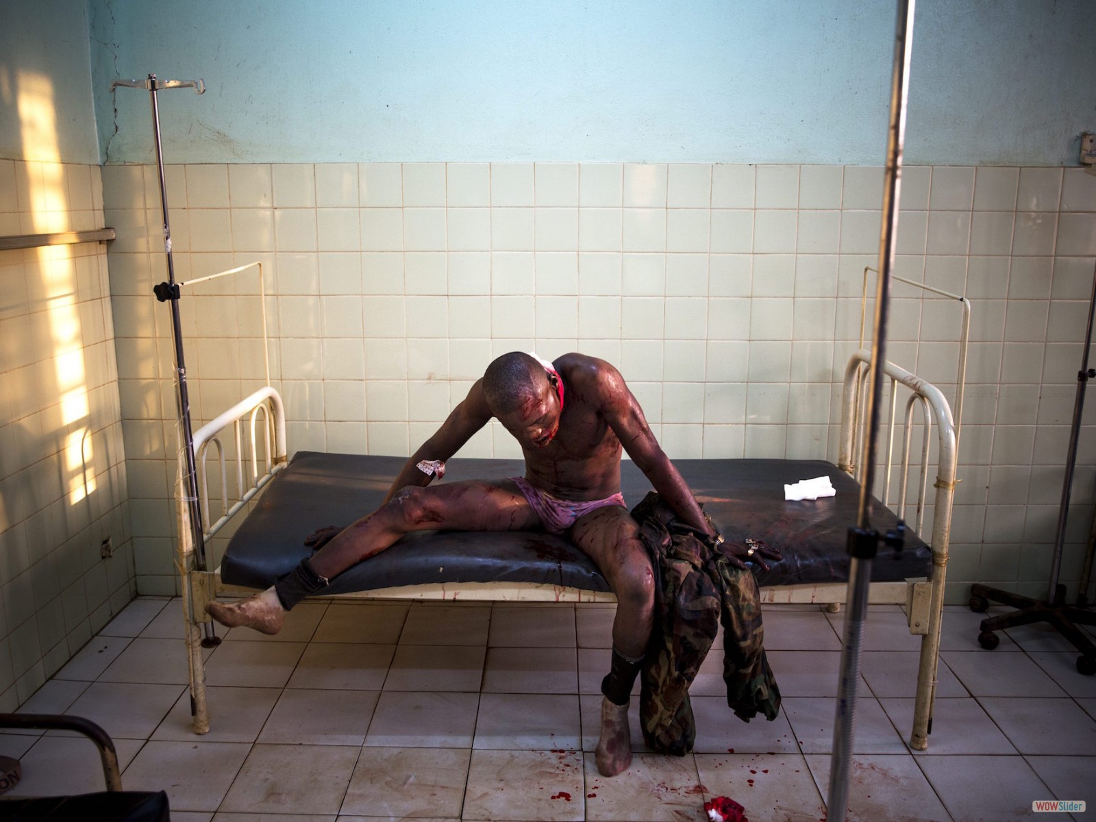 Un chrétien, blessé lors de combats avec des musulmans, attend d’être soigné à l’hôpital communautaire de Bangui.
<br><i><b>

Bangui Community Hospital: a Christian wounded in fighting with Muslims, waiting for medical care.
</b></i>
