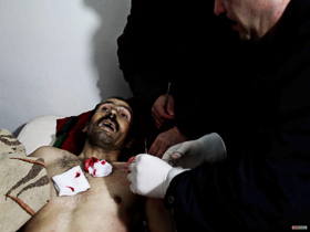  <p class='fr'>
	Quartier de Karm al-Zaytoun, janvier 2012. Les victimes de snipers et de bombe à clous affluent au petit dispensaire improvisé (deux pièces). Un jeune homme, une balle en pleine tête, est amené en urgence. Puis cet homme touché à la poitrine. Puis une femme grièvement blessée à la mâchoire, les yeux remplis d’effroi. Puis un homme victime d’une bombe à clous. Et encore trois hommes, également victimes d’une bombe à clous lancée près d’un autre centre de santé. Malgré les efforts des infirmiers, trois blessés perdront la vie.
	</p> <p class='en'>
	Karm al-Zaytoun neighborhood, January 2012. 

Victims of sniper fire and nail bomb attacks poured into the makeshift two-room medical center. A young man shot in the head was given emergency treatment; this man had been hit in the chest; then a woman with a serious wound to the jaw, staring in horror; next a man injured by a nail bomb that went off near a different healthcare center. The nurses did what they could, but three of the victims died. Karm al-Zaytoun neighborhood, January 2012. 

Victims of sniper fire and nail bomb attacks poured into the makeshift two-room medical center. A young man shot in the head was given emergency treatment; this man had been hit in the chest; then a woman with a serious wound to the jaw, staring in horror; next a man injured by a nail bomb that went off near a different healthcare center. The nurses did what they could, but three of the victims died. 
	</p>