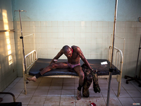  <p class='fr'>
	Un chrétien, blessé lors de combats avec des musulmans, attend d’être soigné à l’hôpital communautaire de Bangui.
	</p> <p class='en'>
	Bangui Community Hospital: a Christian wounded in fighting with Muslims, waiting for medical care.

	</p>